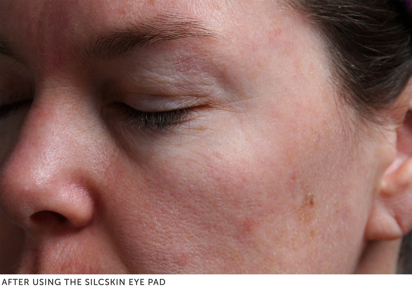 Eye Pads