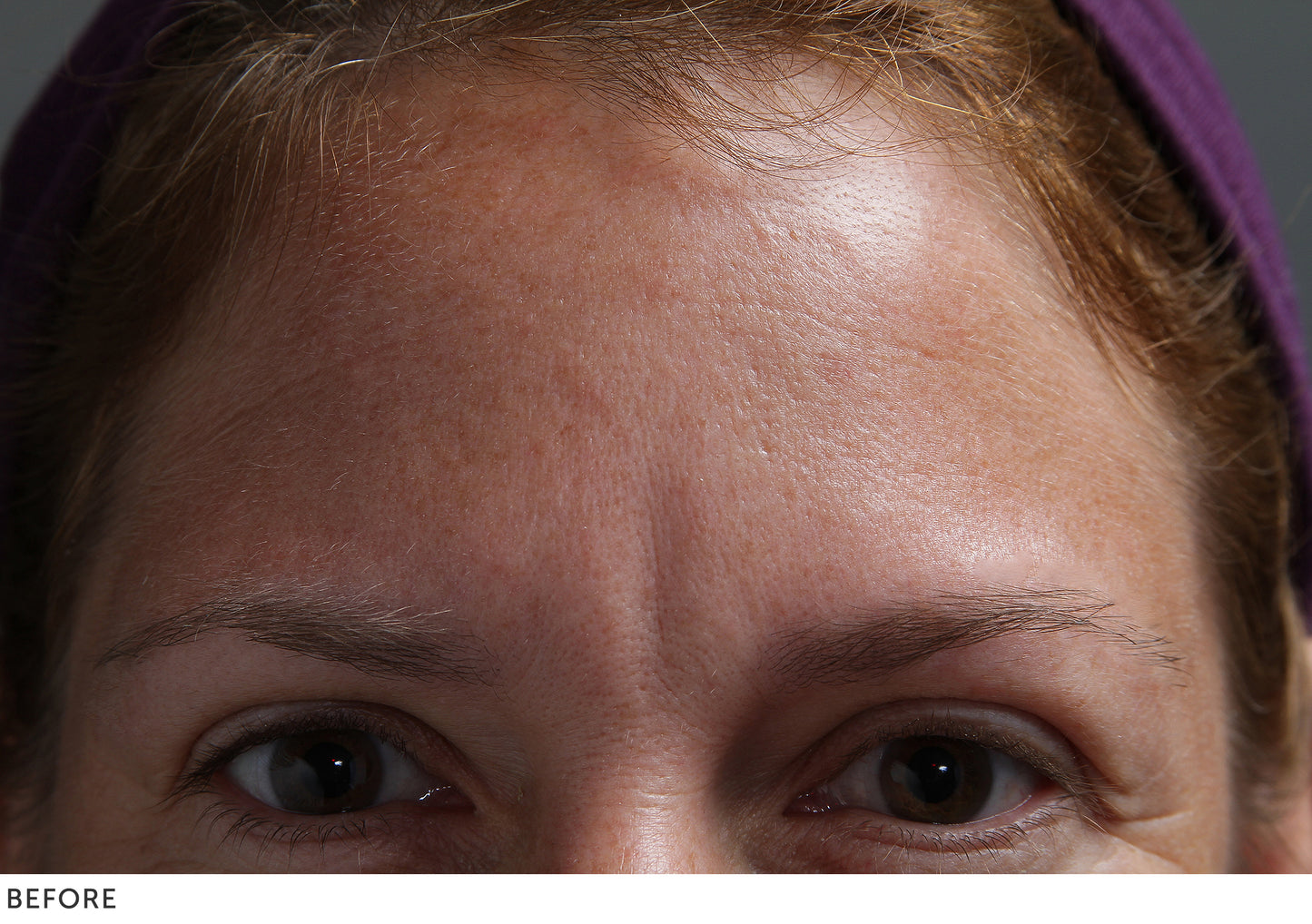 Facial Pads – Brow set