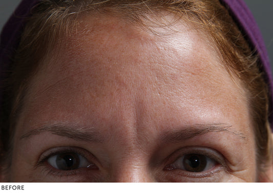 Facial Pads – Brow set